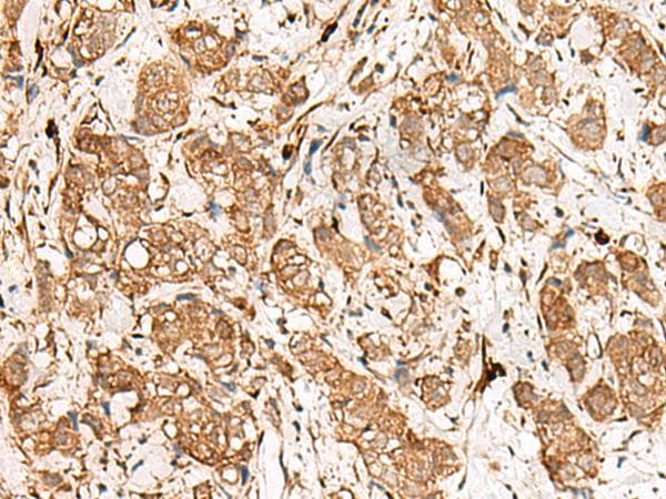 GBP4 / Mpa2 Antibody