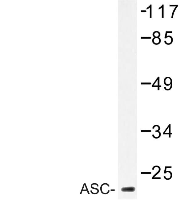 PYCARD / ASC / TMS1 Antibody (Glu13)