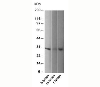 UCHL1 / PGP9.5 Antibody (clone 31A3, Azide-free, BSA-free)