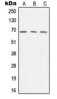MEN1 / Menin Antibody (Internal)