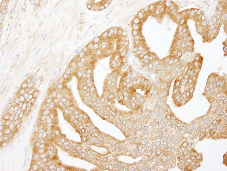 CORO1B Antibody (aa450-489)