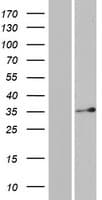 DERA Protein (Over-Expression Lysate Myc-DDK (Flag))