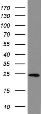 Monoclonal Mouse anti-Human BID Antibody (clone UMAB139, IHC, WB)