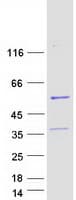 Human LSM14B Protein (Recombinant Myc-DDK (Flag))