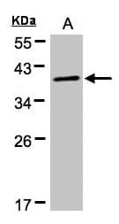 Polyclonal Rabbit anti-Human Proteins, phosphorylated (Pan) Antibody (aa1-351, WB)