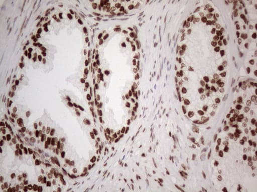 Monoclonal Mouse anti-Human HNRNPL / hnRNP L Antibody (clone OTI4E5, aa270-502, IHC)