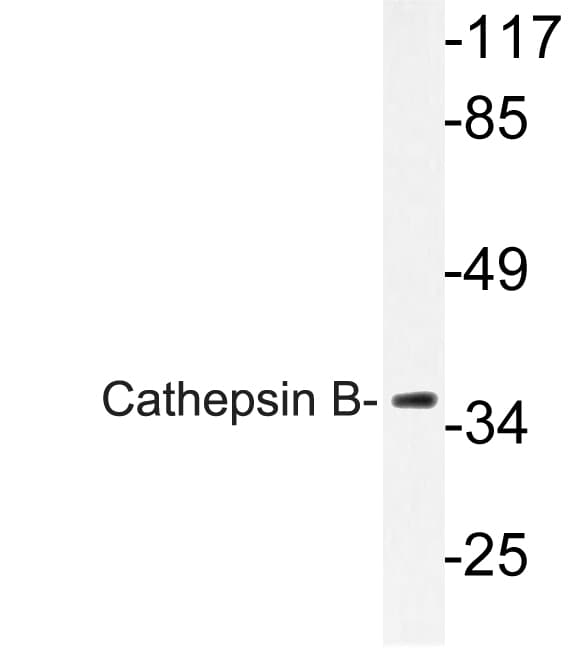 CTSB / Cathepsin B Antibody (Asn217)