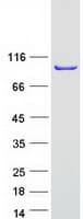 Human PDCD6IP / ALIX Protein (Recombinant Myc-DDK (Flag))