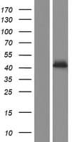 P2RX2 / P2X2 Protein (Over-Expression Lysate Myc-DDK (Flag))