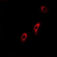 SCAD / ACADS Antibody