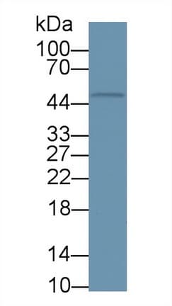 HAVCR1 / KIM-1 Antibody (aa23-125, APC)