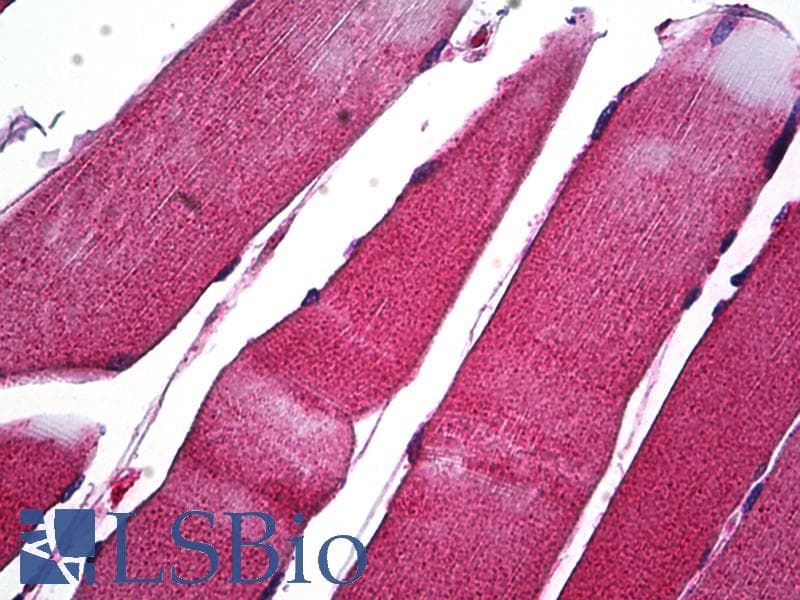 IHC-plus™ MMP1 Antibody (C-Terminus)