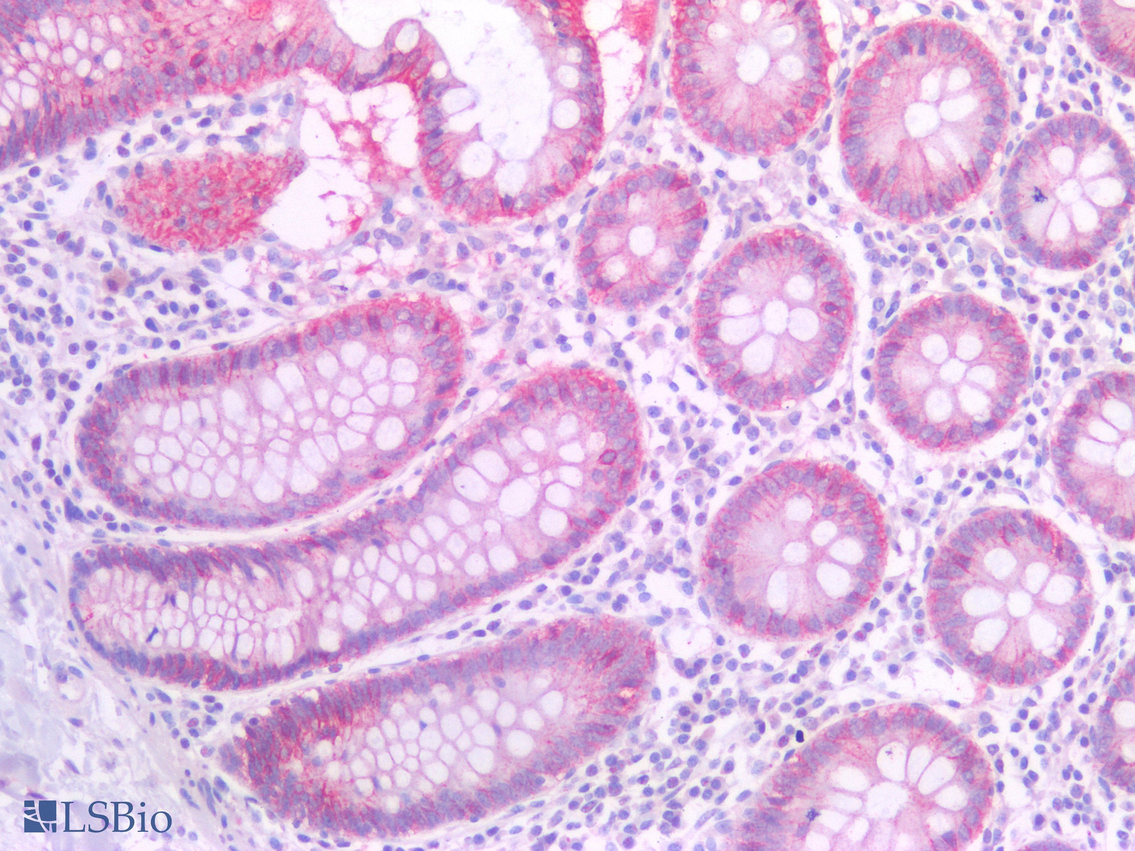 PathPlus™ Polyclonal Rabbit anti-Human CTNND1 / p120 Catenin Antibody (IHC)