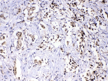 HNRNPF / hnRNP F Antibody