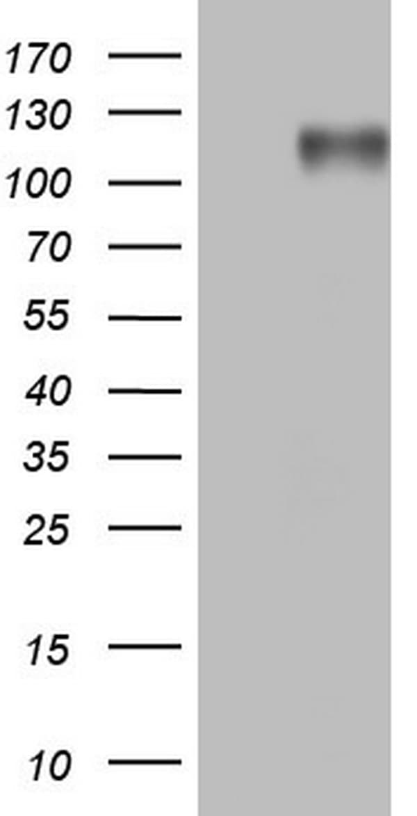 BSAC / MKL1 Antibody (aa165-397, clone OTI2B9)