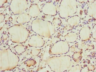 Polyclonal Rabbit anti-Human CCNE2 / Cyclin E2 Antibody (IHC, WB)
