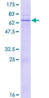 Human LETMD1 / HCCR1 Protein (Recombinant GST)