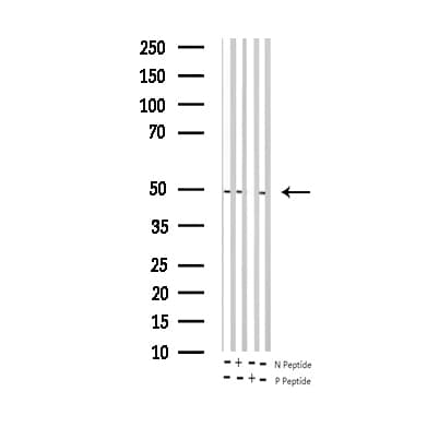 JUN / c-Jun Antibody (phospho-Ser243)