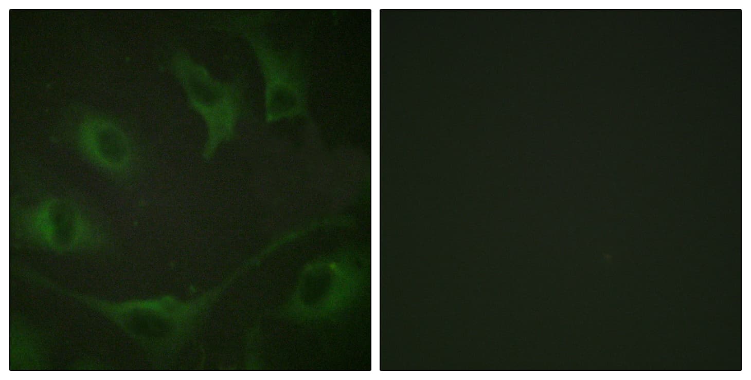 c-CBL Antibody (phospho-Tyr774)