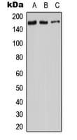 IHC-plus™ ADCY9 / Adenylate Cyclase 9 Antibody (N-Terminus)
