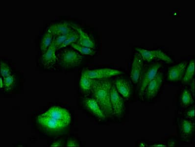 Polyclonal Rabbit anti-Human TXK / RLK Antibody (IHC, IF, WB)
