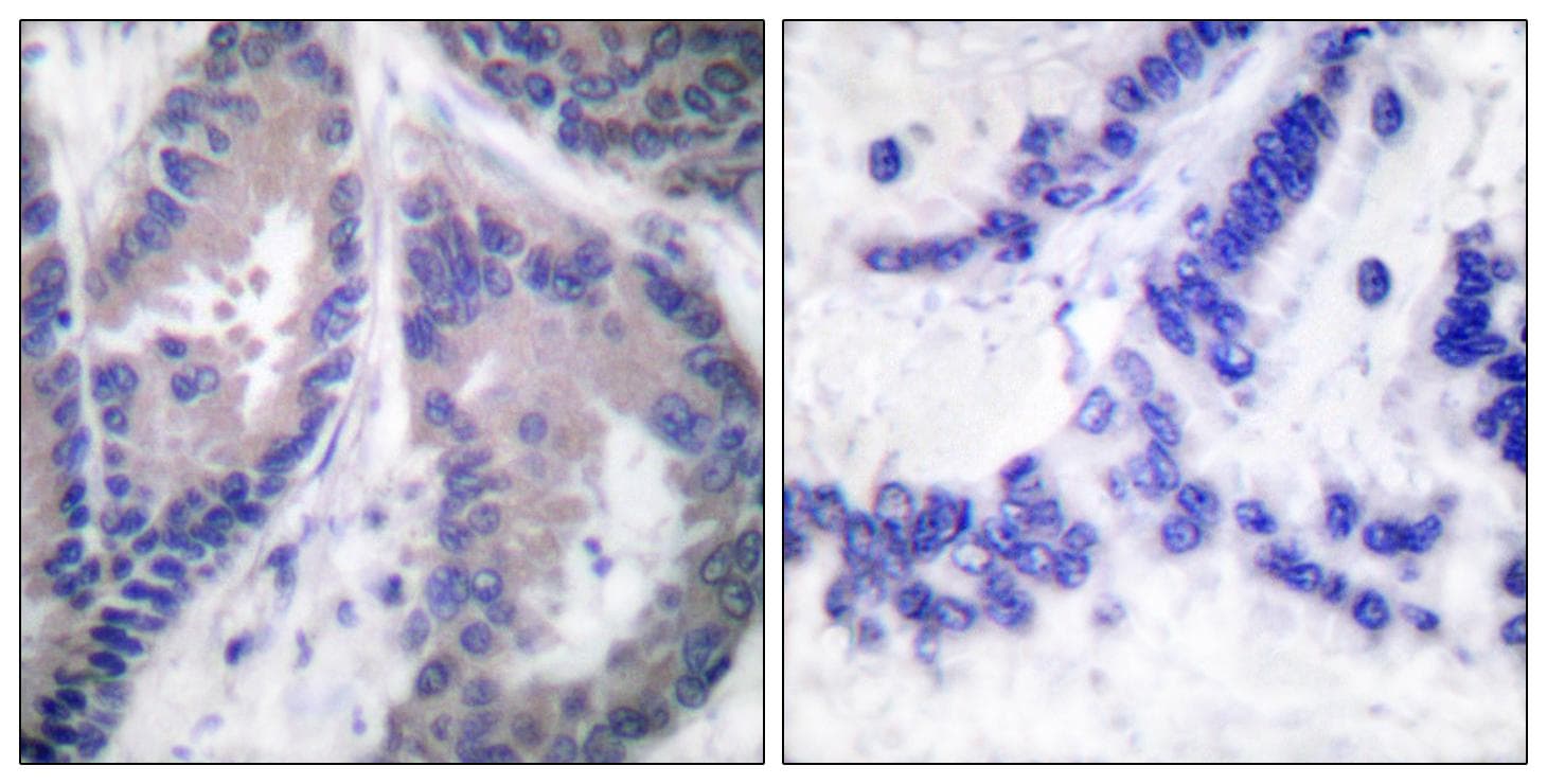 Endostatin Antibody