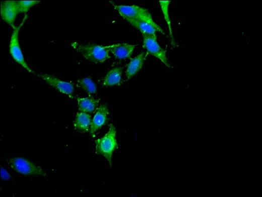 c-CBL Antibody