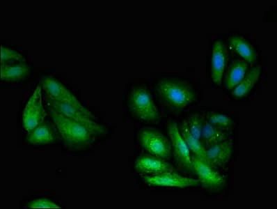 Polyclonal Rabbit anti-Human GNB1 Antibody (IF, WB)