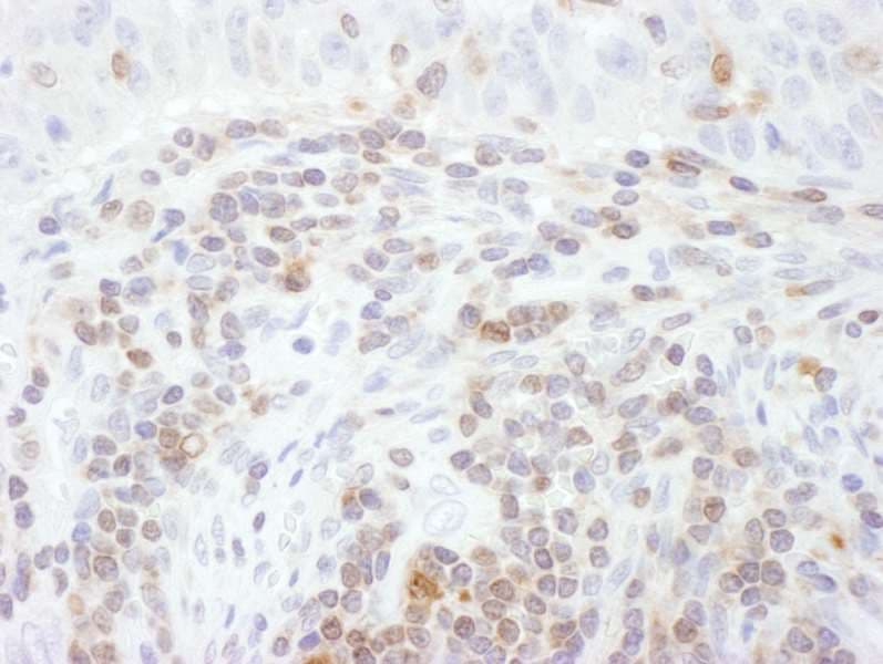 Polyclonal Rabbit anti-Human STAT5A Antibody (aa744-794, IHC, WB)