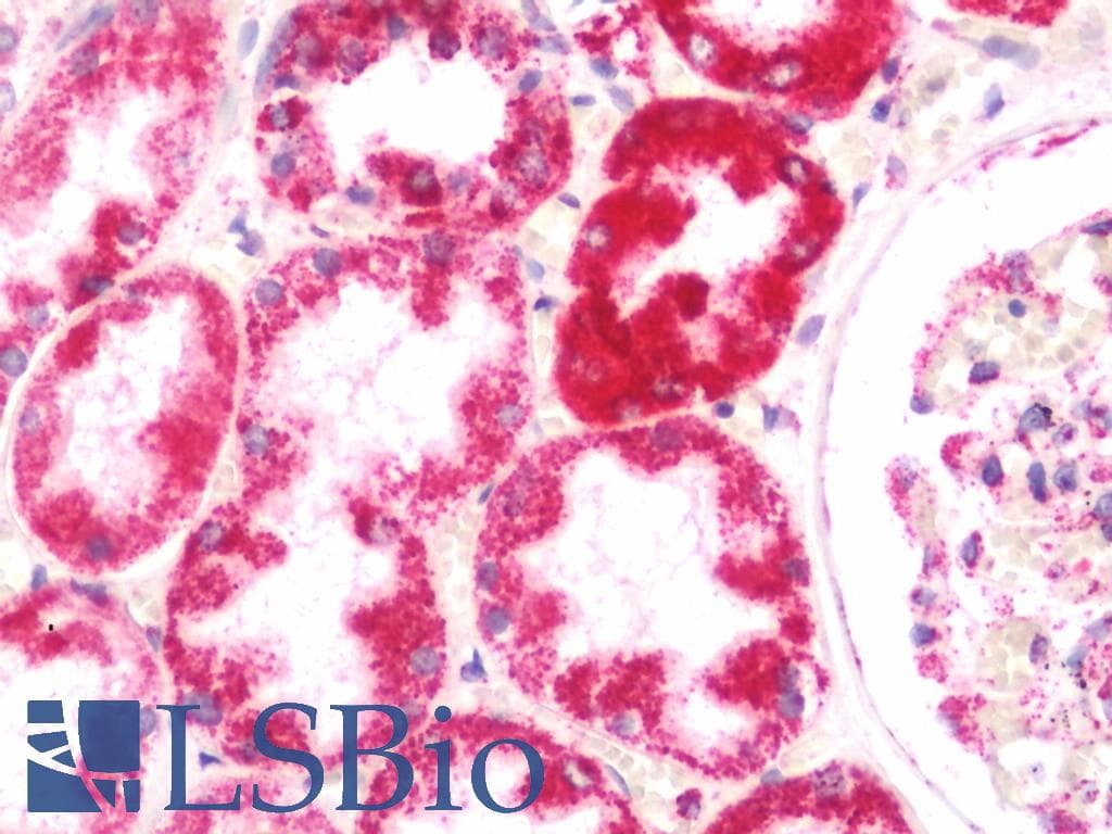 IHC-plus™ SKIV2L / SKI2 Antibody
