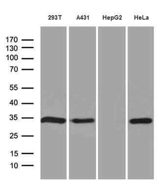 NAT1 / AAC1 Antibody (clone OTI6D7)