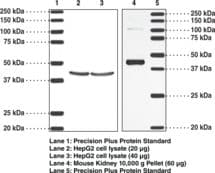 Thromboxane A2 Receptor Antibody