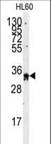 EXOSC8 Antibody (aa243-276)