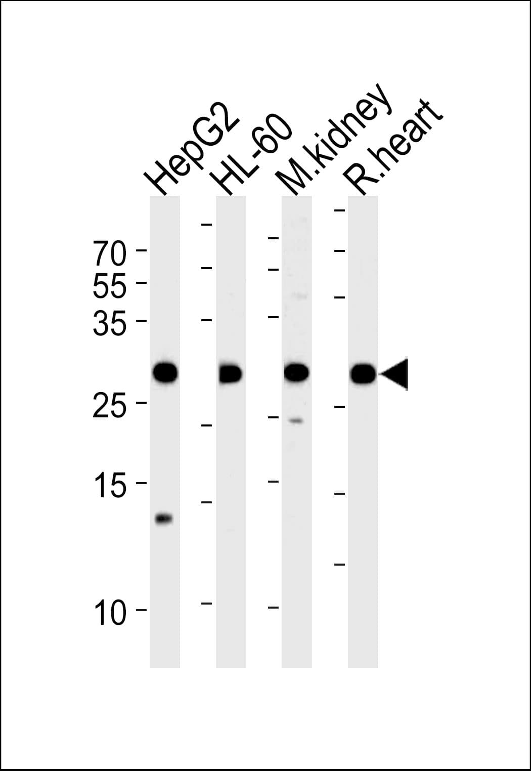 ATP5F1 Antibody (aa161-195)