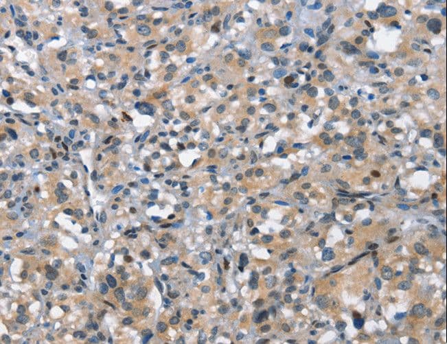 Polyclonal Rabbit anti-Human DDR2 Antibody (IHC)