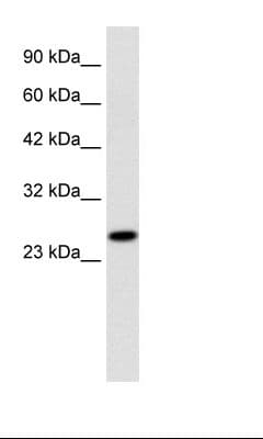 RGS13 Antibody (aa77-126)