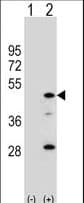 AADAC Antibody (aa273-300)
