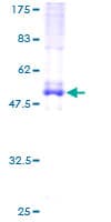 Human EVI2A Protein (Recombinant GST)