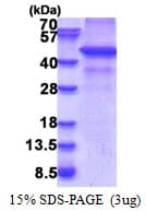 Human RNF34 Protein (Recombinant His)