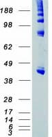 Human BCKDK Protein (Recombinant Myc-DDK (Flag))