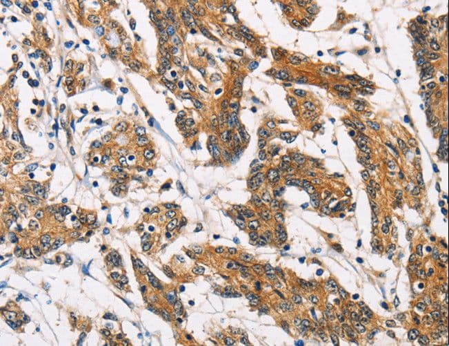ATP2C1 Antibody