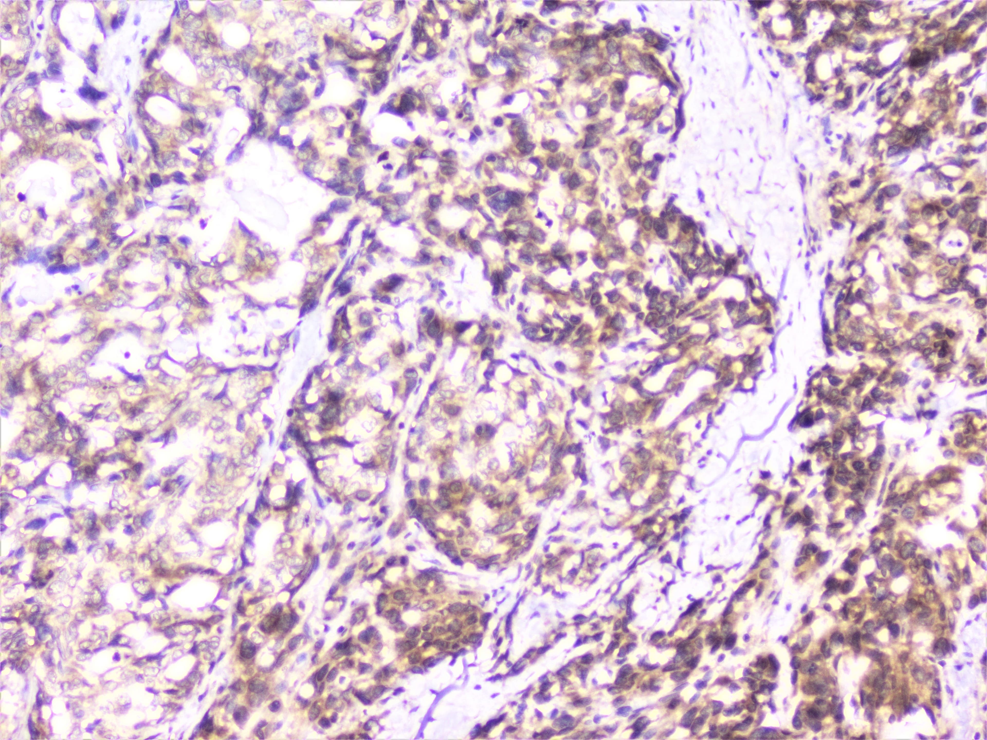 UBE2I / UBC9 Antibody