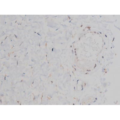 SNCA / Alpha-Synuclein Antibody (phospho-Ser129)
