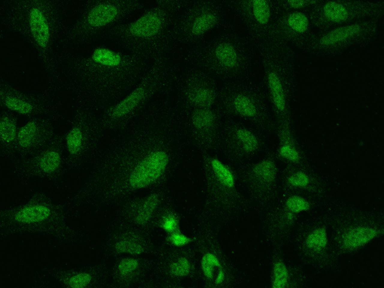 ARHGAP22 / RhoGAP2 Antibody
