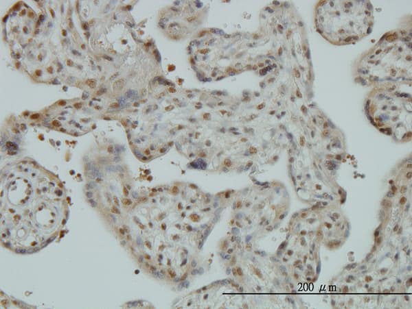 Monoclonal Mouse anti-Human TIP120 / CAND1 Antibody (clone 5D7, IHC, IF, WB)