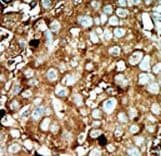 PFK2 / PFKFB3 Antibody (aa454-484)
