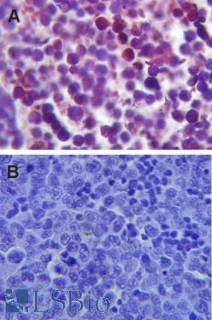 IHC-plus™ TLR4 Antibody (aa420-435)