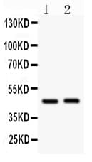 ARRB2 / Beta Arrestin 2 Antibody (aa395-409)