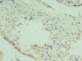 SPAG16 Antibody (aa1-183)