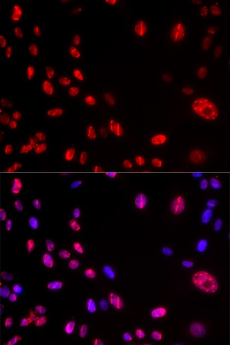 ATM Antibody (phospho-Ser1981)